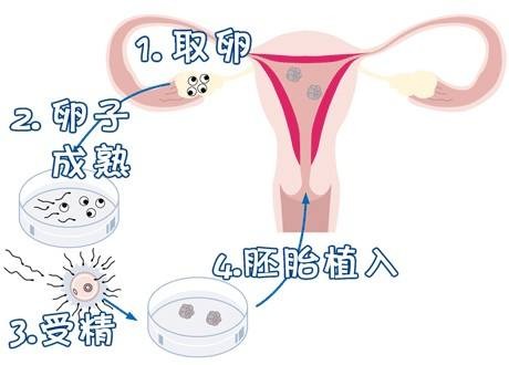 周启明 主任医师
